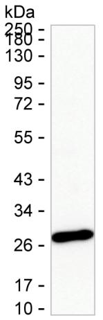 MMAB